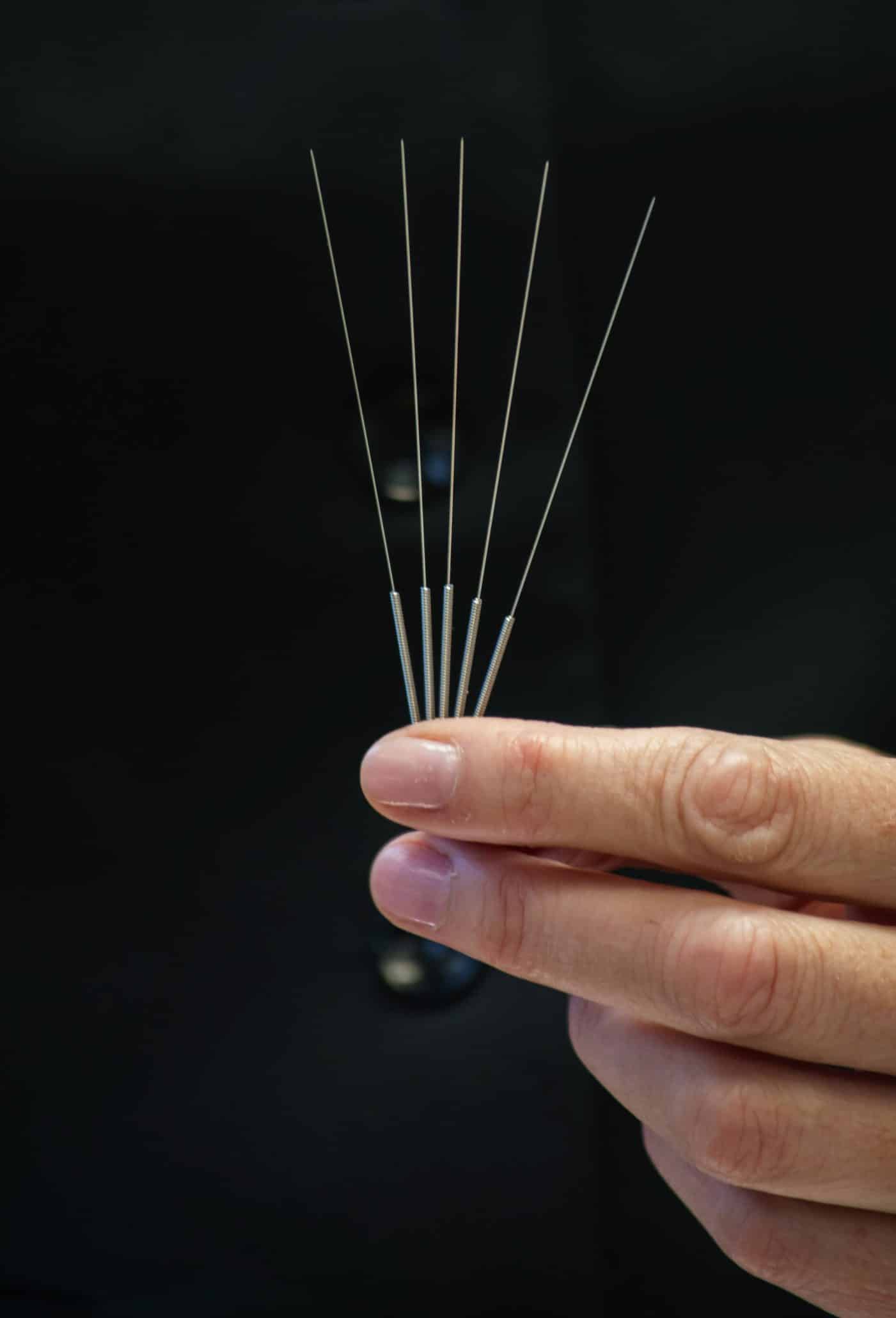 Hand holding acupuncture needles against black background.