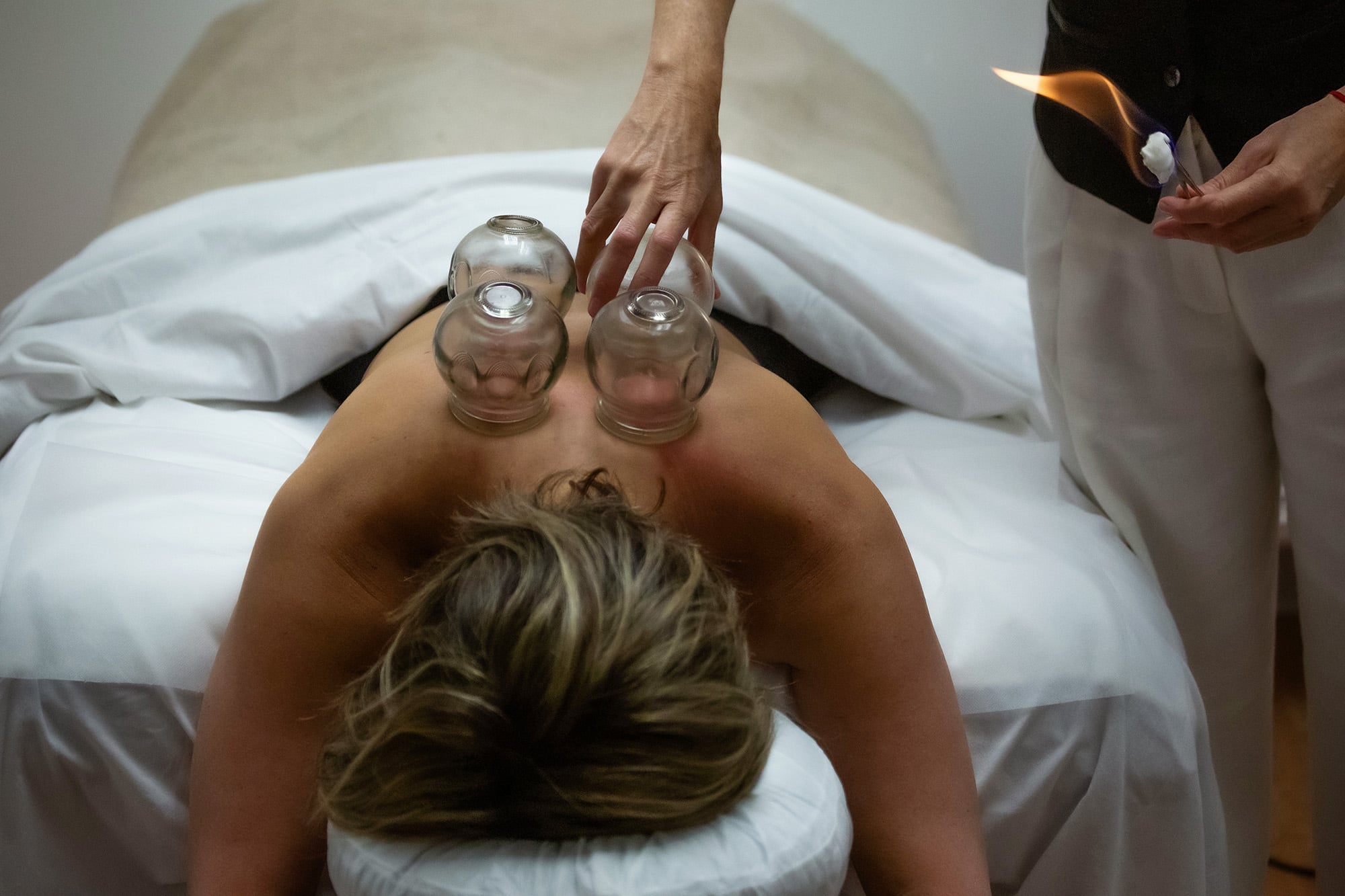 Cupping therapy session in progress with glass cups.