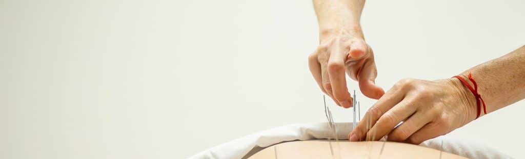 Japanese acupuncture treatment in Houston