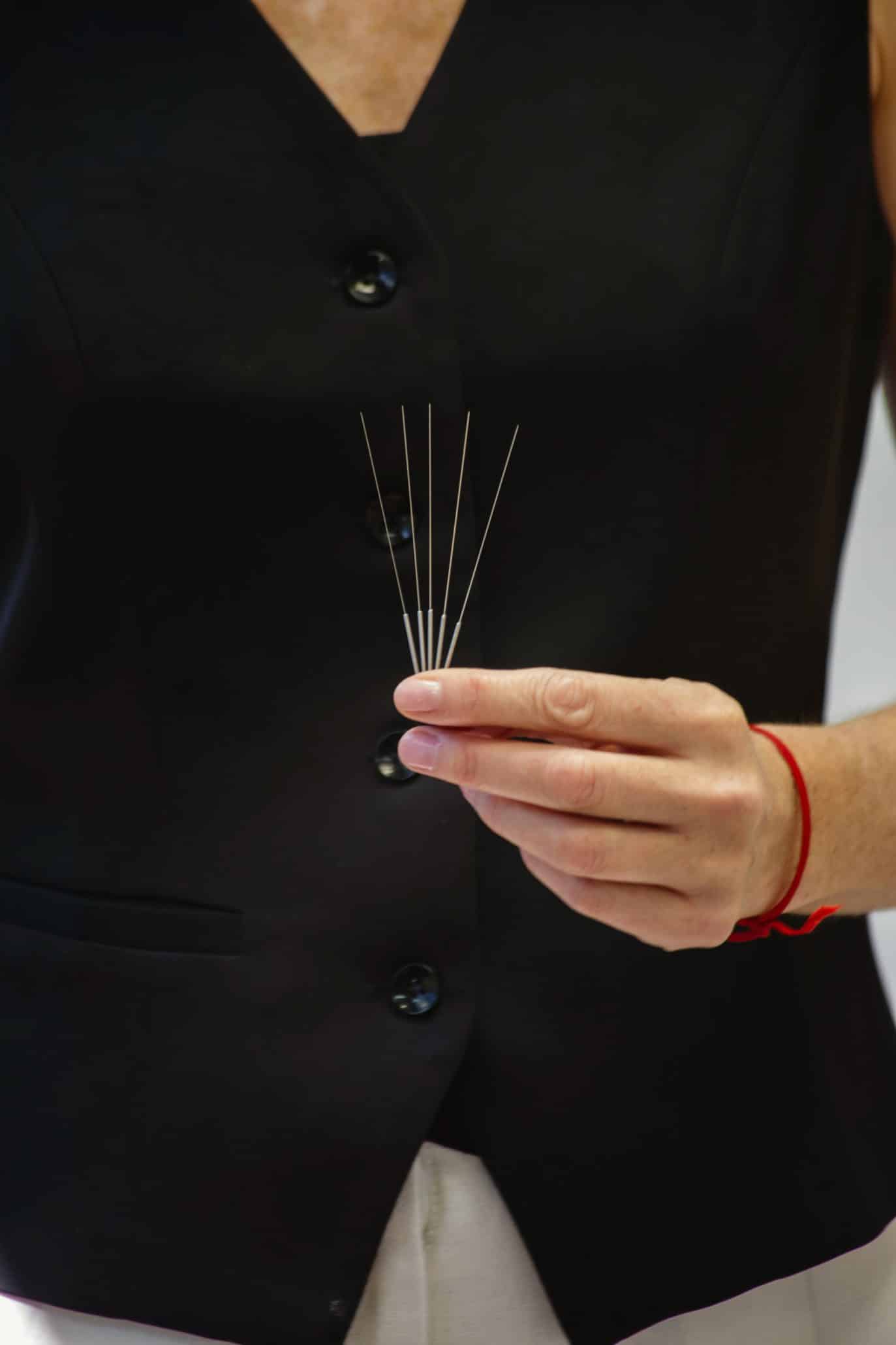 Person holding acupuncture needles in hand.